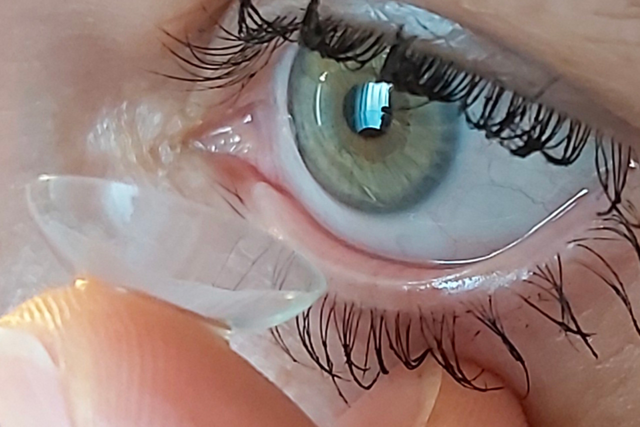 CeresaOttica